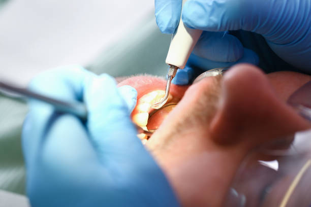 Best Emergency Denture Repair in Harvey, ND