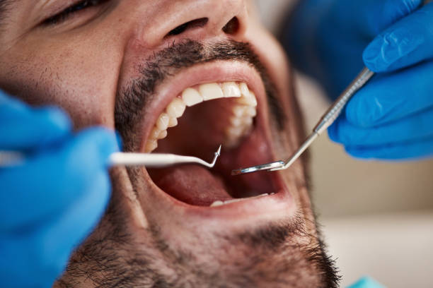 Fast & Reliable Emergency Dental Services in ND