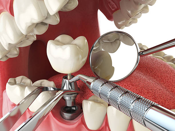 Best Cosmetic Emergency Dentistry in Harvey, ND